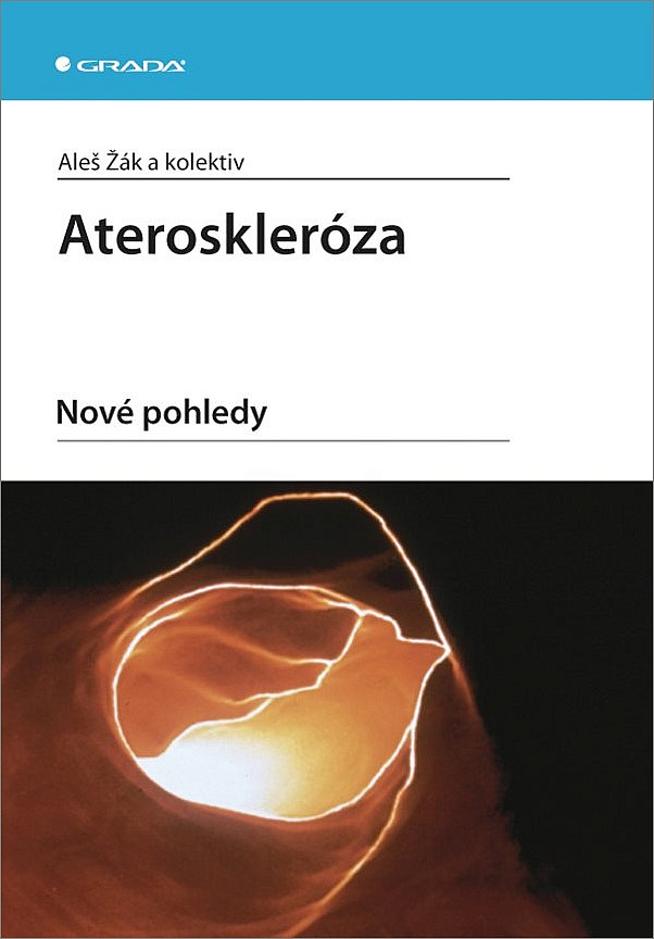 Ateroskleróza - Nové pohledy