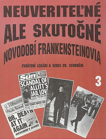 Neuveriteľné, ale skutočné: Zvrátení lekári a vedci 20. storočia  3. - Novodobí Frankensteinovia