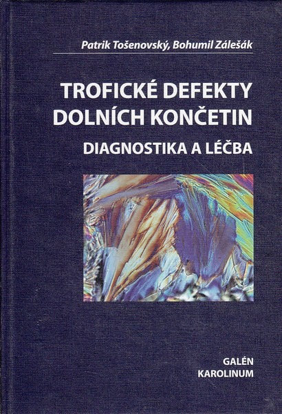 Trofické defekty dolních končetin