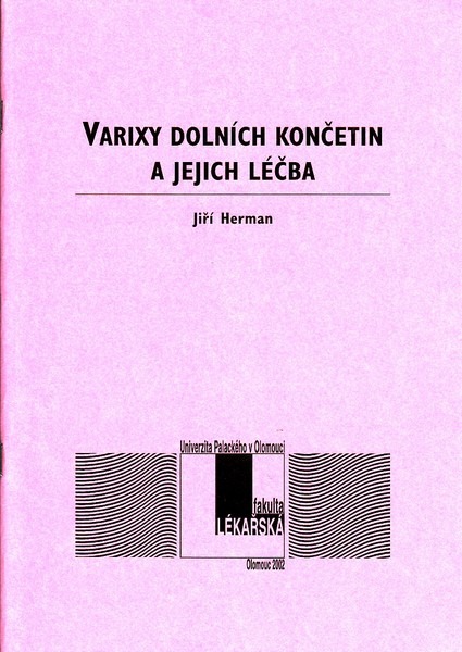 Varixy dolních končetin a jejich léčba