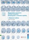 Magnetická rezonance nervové soustavy: radiologické a klinické aspekty. I., Mozkové nádory