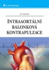 Intraaortální balonková kontrapulzace