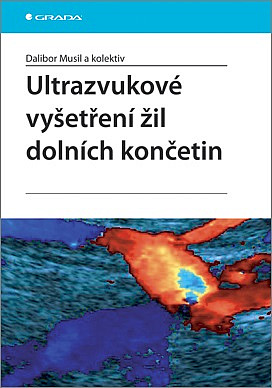 Ultrazvukové vyšetření žil dolních končetin