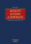 Mozkové ischemie a hemoragie