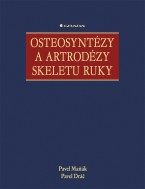 Osteosyntézy a artrodézy skeletu ruky