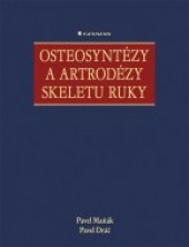 Osteosyntézy a artrodézy skeletu ruky