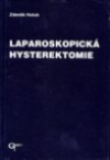 Laparoskopická hysterektomie