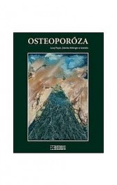 Osteoporóza