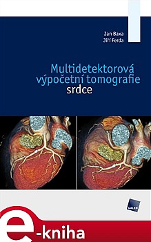 Multidetektorová výpočetní tomografie srdce