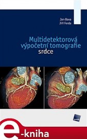 Multidetektorová výpočetní tomografie srdce