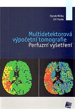 Multidetektorová výpočetní tomografie - Perfuzní vyšetření