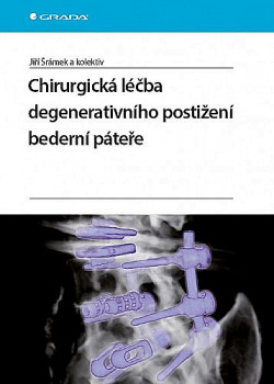 Chirurgická léčba degenerativního postižení bederní páteře