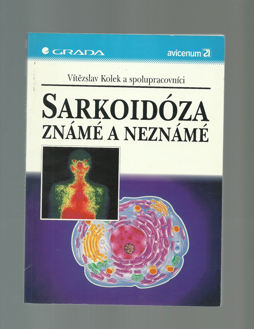 Sarkoidoza známé a neznámé