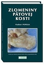 Zlomeniny pätovej kosti