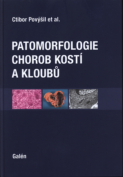 Patomorfologie chorob kostí a kloubů