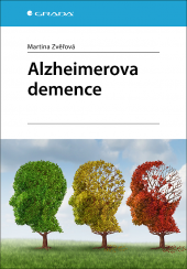 Alzheimerova demence
