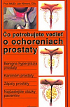 Čo potrebujete vedieť o ochoreniach prostaty