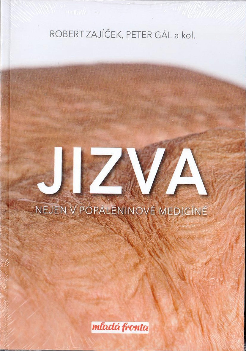 Jizva nejen v popáleninové medicíně