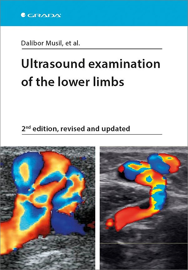 Ultrasound examination of the lower limbs