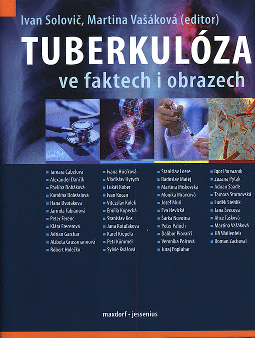 Tuberkulóza ve faktech i obrazech