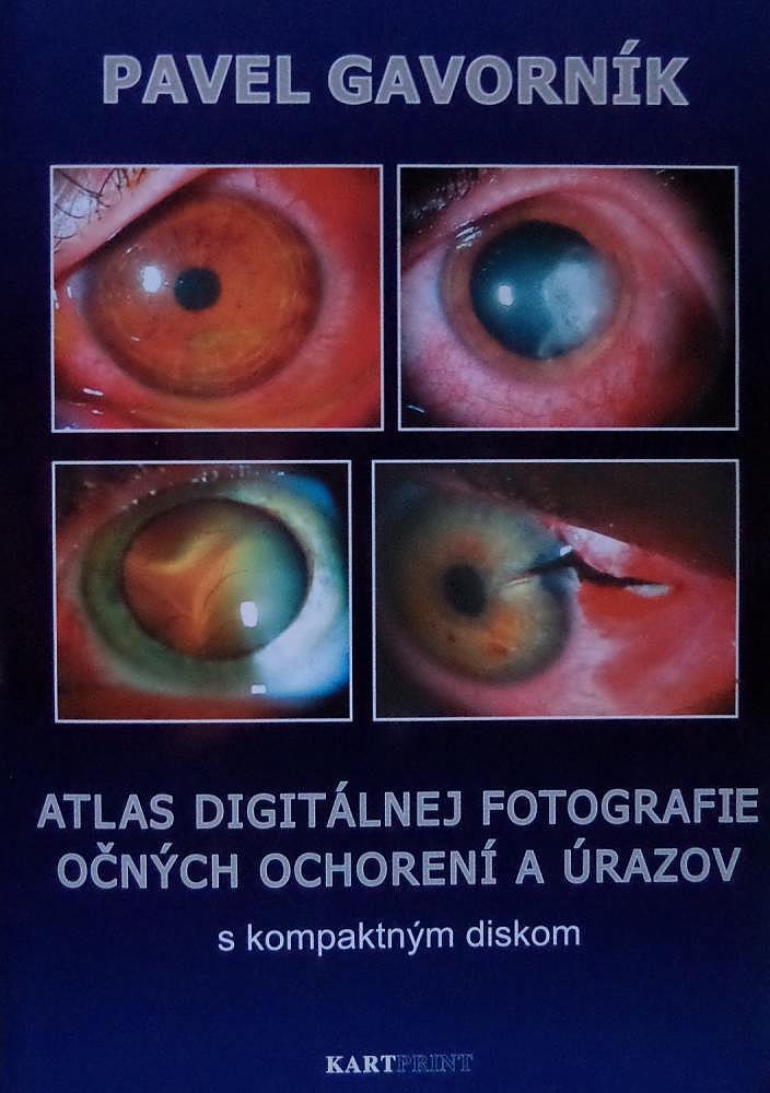 Atlas digitálnej fotografie očných ochorení a úrazov